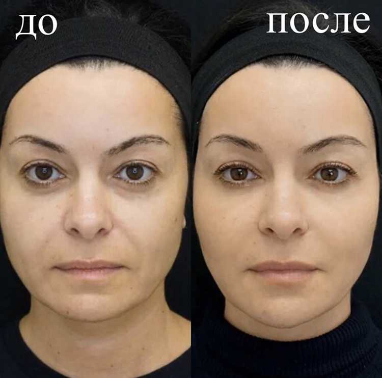 Эмоциональный аспект: Чувства до и после трансформации