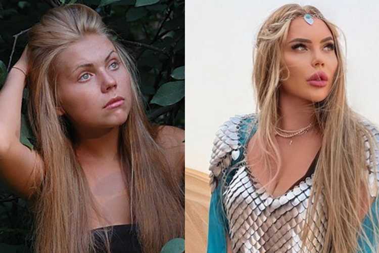Реабилитационный период: что важно знать?