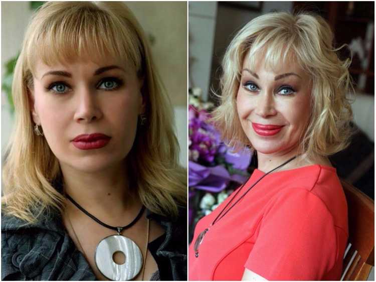 Основные изменения после пластики