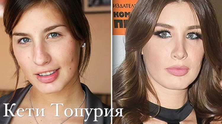 Период восстановления после хирургического вмешательства